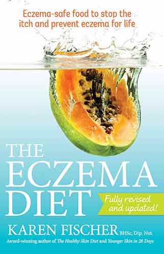The Eczema Diet: Eczema-safe Food to Stop the Itch and Prevent Eczema for Life